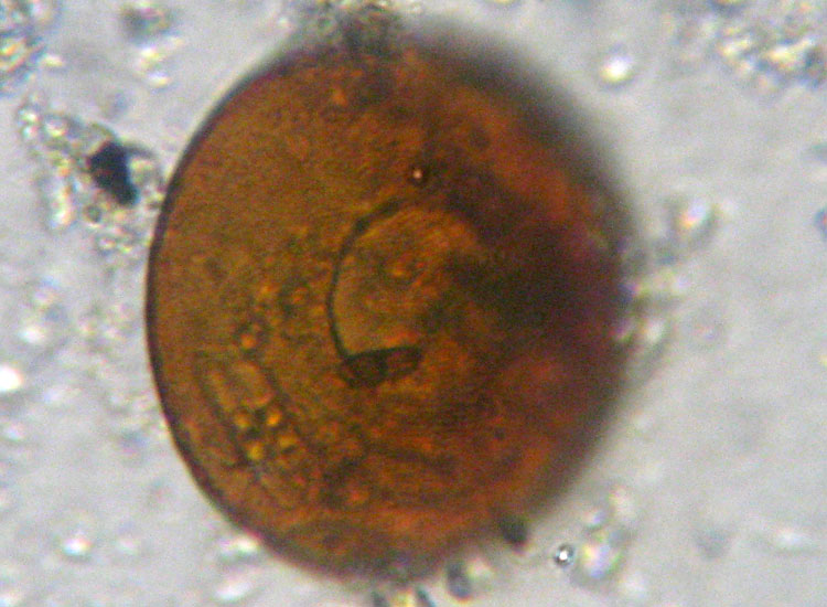Arcella vulgaris